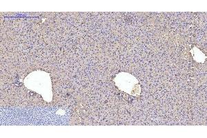 Immunohistochemistry of paraffin-embedded Mouse liver tissue using ACTA1 Monoclonal Antibody at dilution of 1:200.