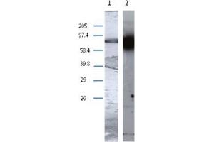 Western Blot analysis using TGM1 antibody Cat. (TGM1 anticorps)