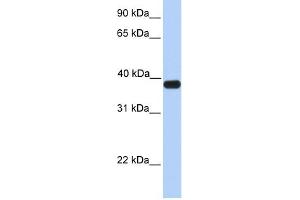 ASB5 antibody used at 1 ug/ml to detect target protein. (ASB5 anticorps  (C-Term))