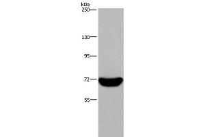 Western Blot analysis of Raji cell using LCP1 Polyclonal Antibody at dilution of 1:300 (LCP1 anticorps)