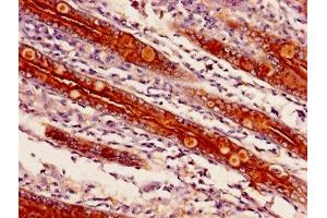 Immunohistochemistry of paraffin-embedded human small intestine tissue using ABIN7143250 at dilution of 1:100 (APEH anticorps  (AA 201-500))