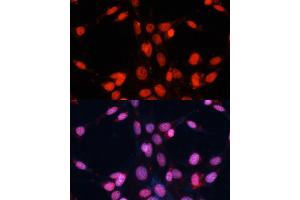 Immunofluorescence analysis of NIH/3T3 cells using FUS antibody (ABIN6127938, ABIN6140818, ABIN6140819 and ABIN7101788) at dilution of 1:100. (FUS anticorps  (AA 297-526))