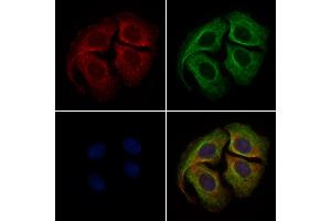 ABIN6261484 and ABIN6279421 staining Hela cells by IF/ICC. (EIF3S1 anticorps  (Internal Region))
