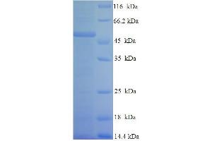 SDS-PAGE (SDS) image for Colony Stimulating Factor 2 Receptor, Alpha, Low-Affinity (Granulocyte-Macrophage) (CSF2RA) (AA 23-320) protein (His-SUMO Tag) (ABIN5709339)