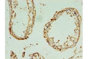 Immunohistochemistry of paraffin-embedded human testis tissue using ABIN7170641 at dilution of 1:100 (RBM11 anticorps  (AA 115-278))