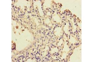Immunohistochemistry of paraffin-embedded human lung tissue using ABIN7175770 at dilution of 1:100 (WDR54 anticorps  (AA 1-334))