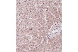 Immunohistochemical analysis of (ABIN655663 and ABIN2845135) on paraffin-embedded Human liver tissue. (ID1 anticorps  (AA 66-93))