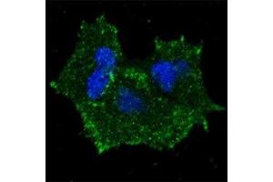 Fluorescent confocal image of MCF7 cells stained with p-ERBB2 antibody.