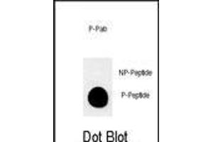 Dot blot analysis of anti-Phospho-MUC1-p Phospho-specific Pab (ABIN650864 and ABIN2839814) on nitrocellulose membrane.