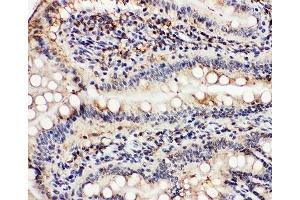 IHC-P: VCP antibody testing of rat intestine tissue (VCP anticorps  (C-Term))