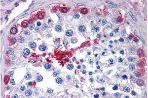 anti-Glucose-6-Phosphate Isomerase (GPI) (AA 81-93) antibody