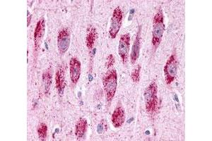 Immunohistochemistry (Formalin/PFA-fixed paraffin-embedded sections) of human brain, neurons and glia with GPR3 polyclonal antibody . (GPR3 anticorps  (2nd Extracellular Domain))