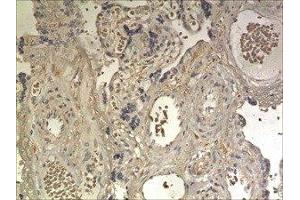 Immunohistochemistry (IHC) image for anti-Colony Stimulating Factor 2 Receptor, Beta (CSF2RB) (AA 23-443) antibody (ABIN1983104)