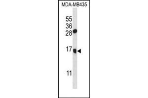 Western blot analysis in MDA-MB435 cell line lysates (35 ug/lane) using GNLY Antibody (C-term) Cat. (GNLY anticorps  (N-Term))