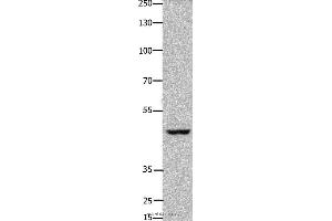 Western blot analysis of Hela cell, using FOXD3 Polyclonal Antibody at dilution of 1:450 (FOXD3 anticorps)