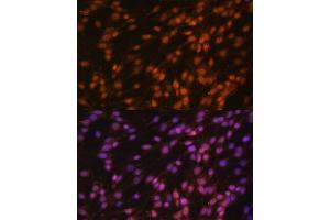 Immunofluorescence analysis of C6 cells using FUBP1 antibody (ABIN6130392, ABIN6140802, ABIN6140804 and ABIN6221231) at dilution of 1:100. (FUBP1 anticorps  (AA 302-644))