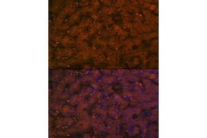 Immunofluorescence analysis of human liver using Complement C4A Rabbit mAb (ABIN7266481) at dilution of 1:100 (40x lens).