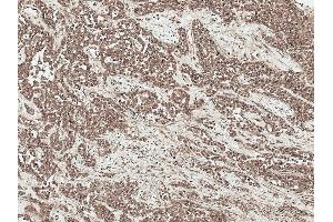 Immunohistochemistry analysis using Rabbit Anti-SFRP2 Polyclonal Antibody (ABIN5696098).