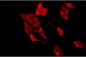 ABIN6277679 staining HT29 by IF/ICC. (Serotonin Receptor 3A anticorps  (Internal Region))