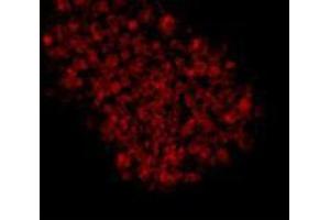 Immunocytochemistry (ICC) image for anti-Epithelial Cell Adhesion Molecule (EPCAM) antibody (ABIN1854891)