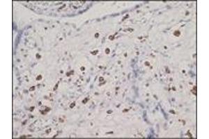 Immunohistochemistry (IHC) image for anti-CD163 (CD163) (N-Term) antibody (ABIN870404) (CD163 anticorps  (N-Term))
