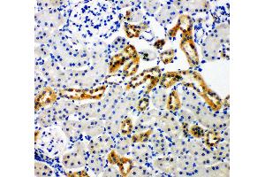 Anti-NADPH oxidase 4 antibody, IHC(P) IHC(P): Rat Kidney Tissue (NADPH Oxidase 4 anticorps  (C-Term))