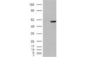 Image no. 2 for anti-Fumarate Hydratase (FH) (Internal Region) antibody (ABIN374767) (FH anticorps  (Internal Region))