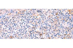 Immunohistochemistry of paraffin-embedded Human tonsil tissue using FUCA2 Polyclonal Antibody at dilution of 1:70(x200)