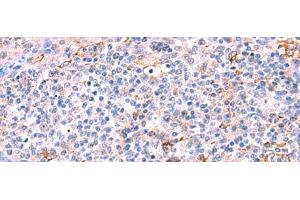 Immunohistochemistry of paraffin-embedded Human tonsil tissue using FUCA2 Polyclonal Antibody at dilution of 1:70(x200) (FUCA2 anticorps)