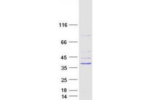 Validation with Western Blot