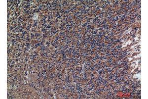Immunohistochemistry (IHC) analysis of paraffin-embedded Human Brain, antibody was diluted at 1:200. (CD56 anticorps)