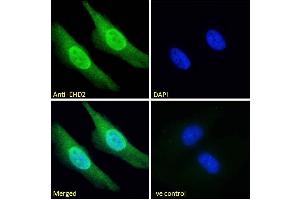 ABIN185287 Immunofluorescence analysis of paraformaldehyde fixed HeLa cells, permeabilized with 0.