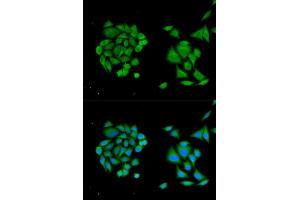 Immunofluorescence analysis of HeLa cells using DDX58 antibody. (DDX58 anticorps  (C-Term))