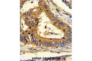 Immunohistochemistry (IHC) image for anti-SREBF chaperone (SCAP) antibody (ABIN3003807)