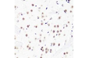 Immunohistochemistry of paraffin-embedded mouse brain using H3R2me2a antibody.