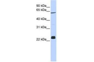 Image no. 1 for anti-H1 Histone Family, Member 0 (H1F0) (AA 36-85) antibody (ABIN6741265) (Histone H1 anticorps  (AA 36-85))