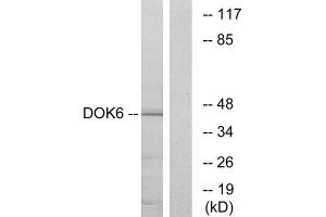 Western blot analysis of extracts from COLO cells, using DOK6 antibody. (DOK6 anticorps  (Internal Region))