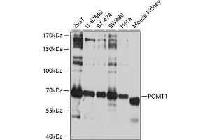 Western blot analysis of extracts of various cell lines, using POMT1 antibody (ABIN6132825, ABIN6145953, ABIN6145954 and ABIN6214473) at 1:1000 dilution. (POMT1 anticorps  (AA 310-550))