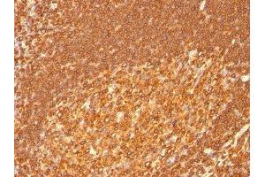 Image no. 1 for anti-Major Histocompatibility Complex, Class II, DR beta 1 (HLA-DRB1) antibody (ABIN6186381)