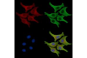 ABIN7095912 and ABIN7099974 staining HepG2 cells by IF/ICC. (NXNL2 anticorps)