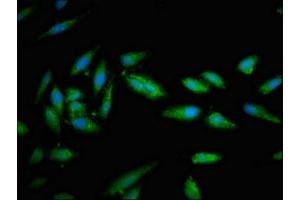 Immunofluorescent analysis of Hela cells using ABIN7171253 at dilution of 1:100 and Alexa Fluor 488-congugated AffiniPure Goat Anti-Rabbit IgG(H+L)