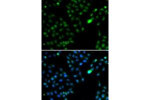 Immunofluorescence analysis of HeLa cells using FKBP3 antibody.