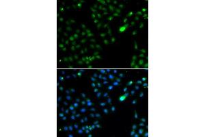 Immunofluorescence analysis of HeLa cells using FKBP3 antibody. (FKBP3 anticorps  (AA 1-224))