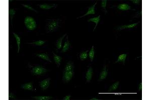 Immunofluorescence of purified MaxPab antibody to TBC1D1 on HeLa cell.