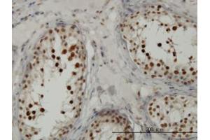 Image no. 5 for anti-Transcription Factor 19 (TCF19) (AA 17-103) antibody (ABIN598965) (TCF19 anticorps  (AA 17-103))