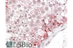 ABIN302166 (3. (CX3CL1 anticorps  (Internal Region))