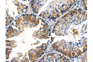 Phospho-MEKK1 (Thr1400) Antibody at 1/100 staining Mouse testis tissue by IHC-P. (MAP3K1 anticorps  (pThr1400))