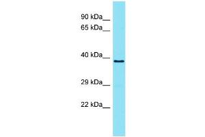 Host: Rabbit Target Name: TMEM121 Sample Type: ACHN Whole Cell lysates Antibody Dilution: 1. (TMEM121 anticorps  (N-Term))
