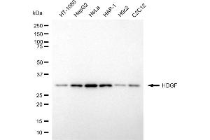 anti-Hepatoma-Derived Growth Factor (HDGF) antibody