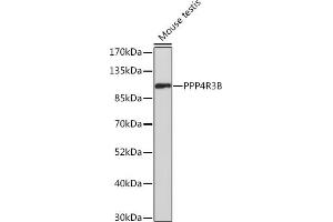 Western blot analysis of extracts of Mouse testis, using PPP4R3B Rabbit pAb (ABIN7270374) at 1:500 dilution. (SMEK2 anticorps  (AA 628-817))